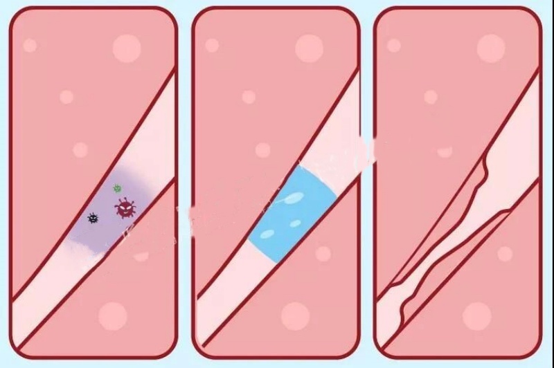 一侧输卵管切除对怀孕的影响有多大？